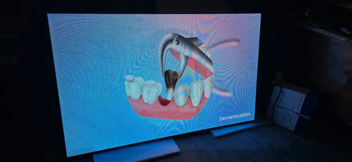 Ekran LED për klinikë dentare